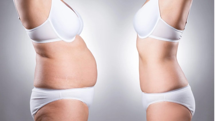 Tiêm giảm béo cho mặt và body. Phương pháp Lipolysis
